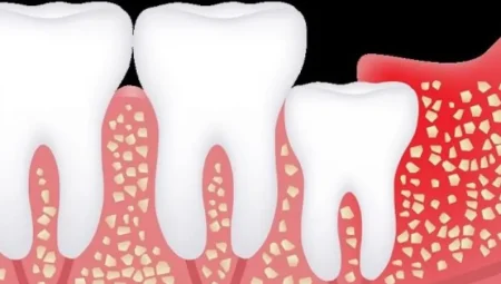 Evrimsel Geçmişimizden Kalan, Artık Gereksiz Olmuş Organlar: Apandisten Yirmilik Dişlere
